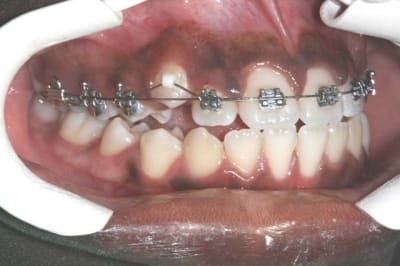 Img 1 afjclb - Eugenol