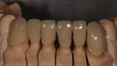 Img 2008w mhqbe9 - Eugenol