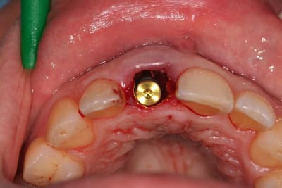 Img 2011 jcwphp - Eugenol