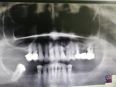 Img 20170303 190541 rpavz5 - Eugenol