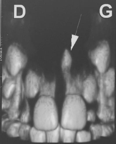 Img 2025 pfsysa - Eugenol