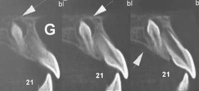 Img 2027 hini82 - Eugenol
