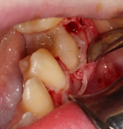 Img 2063 scy8wy - Eugenol