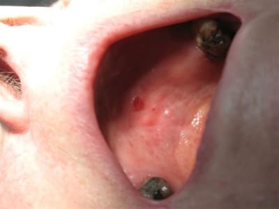 Img 2089 zmfdqw - Eugenol