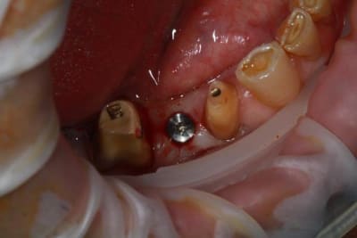 Img 2111 nvfgu1 - Eugenol