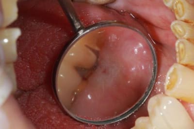 Img 2117 kzozk3 - Eugenol