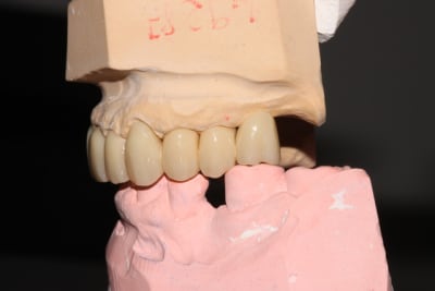 Img 2167 feaucn - Eugenol