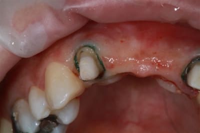 Img 2182 lhh6e0 - Eugenol