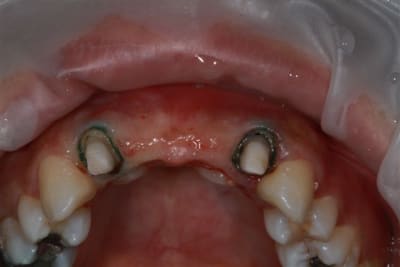 Img 2183 pmo5my - Eugenol