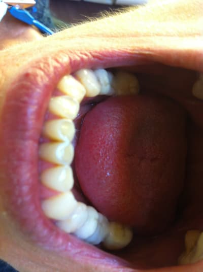 Img 2225 lcjalq - Eugenol