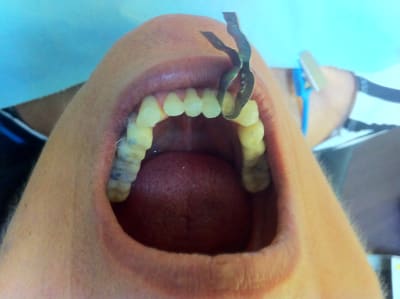 Img 2246 gk6qin - Eugenol