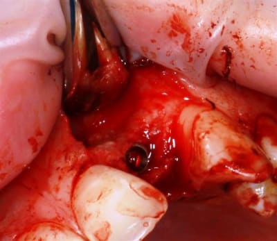 Img 2255 q8ixyy - Eugenol