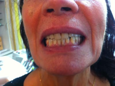 Img 2294 fx9wzj - Eugenol