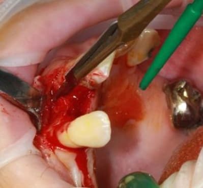 Img 2346 wontdw - Eugenol