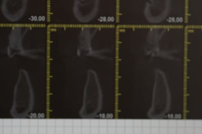 Img 2385 fe5vcs - Eugenol