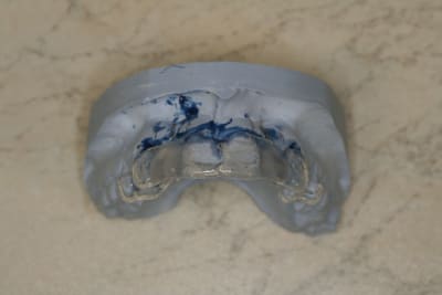 Img 2646 fwyjis - Eugenol