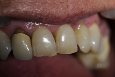 Img 2663 wtsr6k - Eugenol