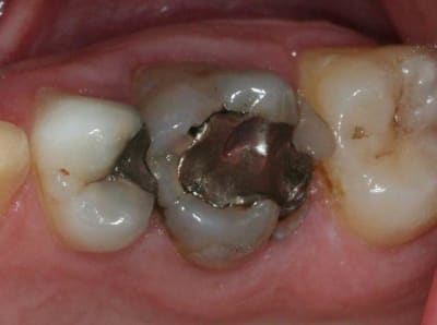 Img 2731 apfcja - Eugenol