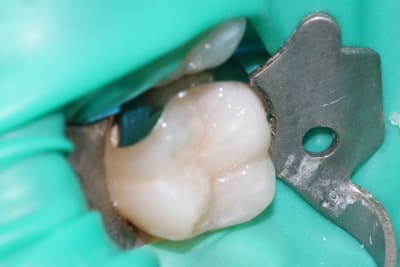 Img 2760 spq03j - Eugenol