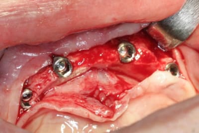 Img 2789 k8w6kq - Eugenol