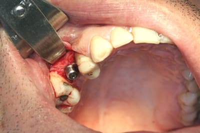 Img 2809 cge46c - Eugenol