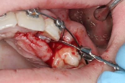 Img 2894 dhgiyz - Eugenol