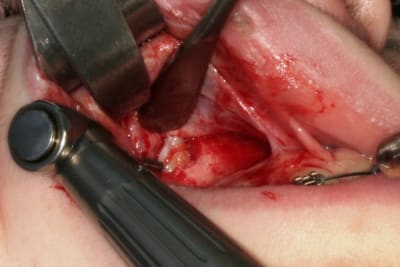 Img 2927 vqw7i1 - Eugenol