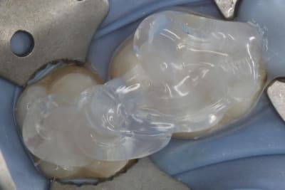 Img 2985 omki07 - Eugenol