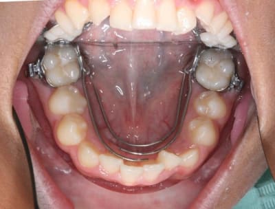 Img 2 xeyfka - Eugenol