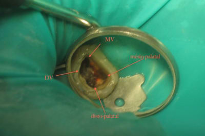 Img 3012 dybbct - Eugenol