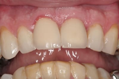 Img 3031 xzaslk - Eugenol