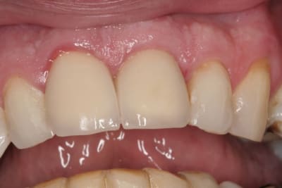 Img 3032 jojp8s - Eugenol