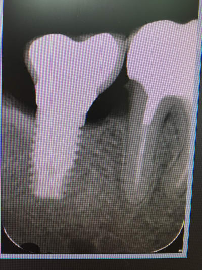 Img 3082 qbzhvw - Eugenol