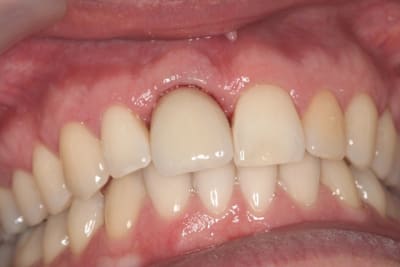 Img 3106 d2rlpg - Eugenol