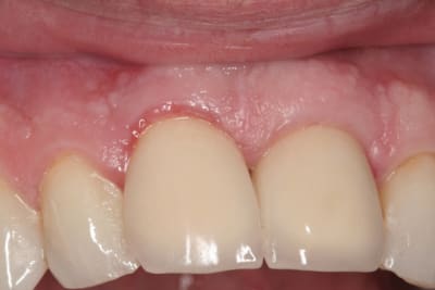 Img 3108 haqvx5 - Eugenol