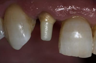 Img 3170 o4lac0 - Eugenol