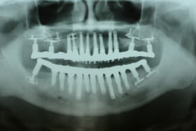 Img 3227 c4ov9t - Eugenol