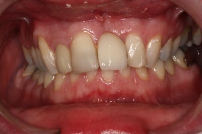 Img 3276 qzbokb - Eugenol