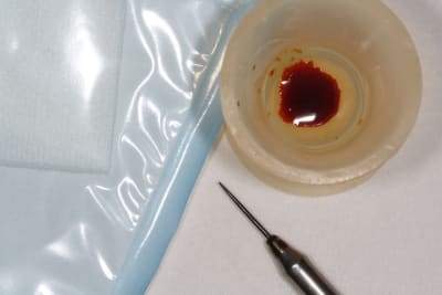 Img 3359 oveyci - Eugenol