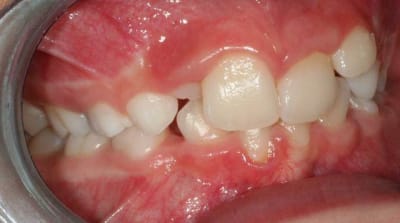 Img 3361 vit1us - Eugenol