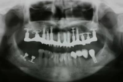 Img 3480 uqdthb - Eugenol