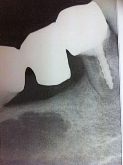 Img 3792 eamebx - Eugenol