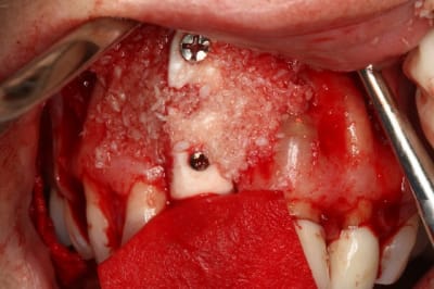 Img 3921  50   x86elb - Eugenol