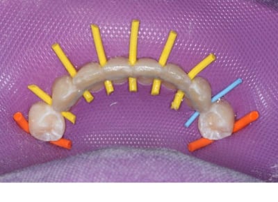 Img 3 ituagt - Eugenol