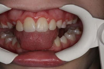 Img 3 rlovt4 - Eugenol