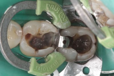 Img 4188 fref6x - Eugenol