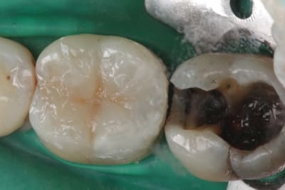 Img 4190 jil7hl - Eugenol