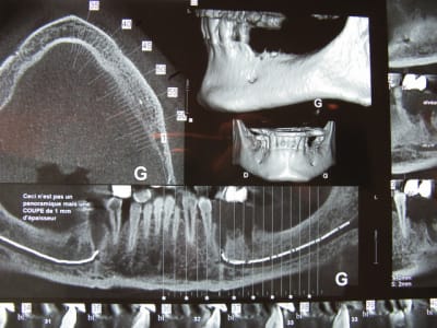 Img 4227 zj4x4i - Eugenol