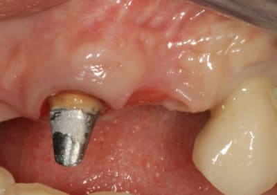 Img 4235 ma1w0g - Eugenol