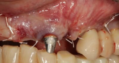 Img 4242 yidxxu - Eugenol